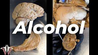 What Alcohol Does to Your Body
