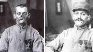 Sculptor Made Masks for Wounded WWI Soldiers with Disfigured Faces | New York Post