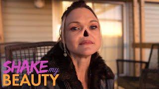 I Lost My Nose To Cancer | SHAKE MY BEAUTY