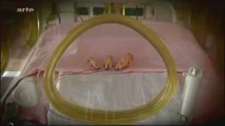 Die künstliche Gebärmutter - Maschine statt Mama - Doku