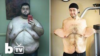 Yes, you can !  My 300lbs Weight Loss Left Me With 13lbs Of Loose Skin