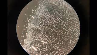 Bilder von einem Impfstoff unter dem Mikroskop