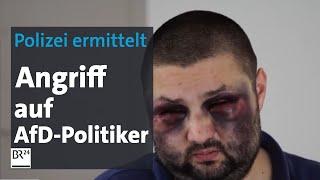 AfD-Politiker Andreas Jurca wurde brutal zusammen geschlagen - BR24