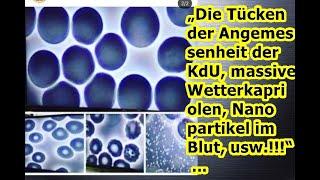 „Die Tücken der Angemessenheit der KdU, massive Wetterkapriolen, Nanopartikel im Blut, usw.!!!“ ...