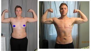 Was Hormone bewirken - FTM Transition: One Year on Testosterone